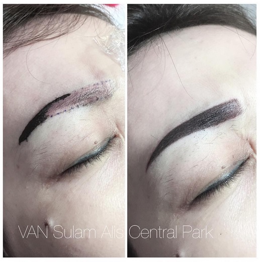 Shading Alis di Central Park