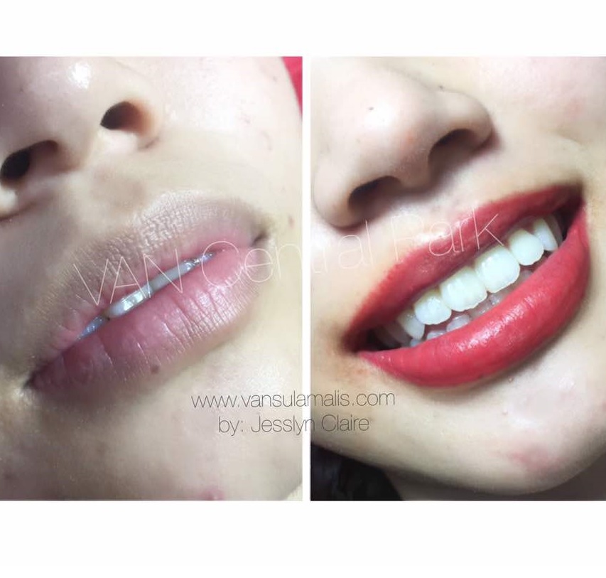 Sulam Bibir Nano Natural di Central Park