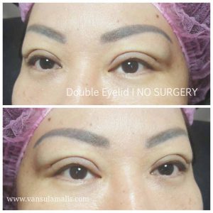 Hasil Sulam Lipatan Mata atau Double Eyelid