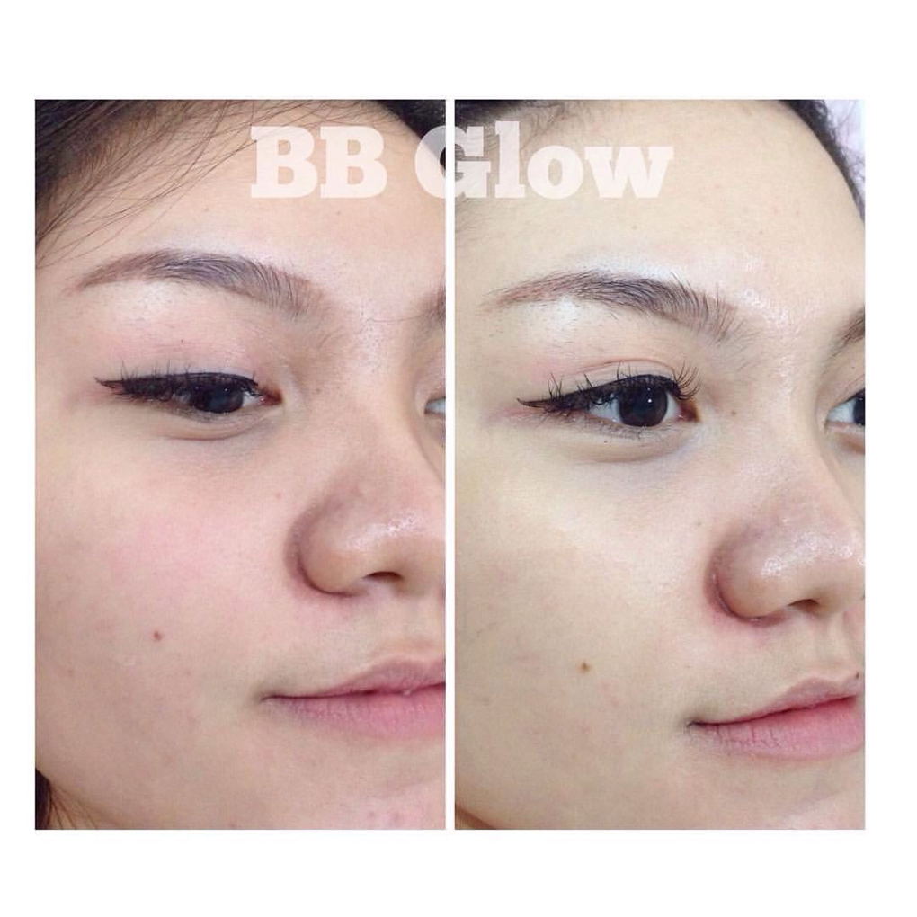 BB Glow 1x Treatment