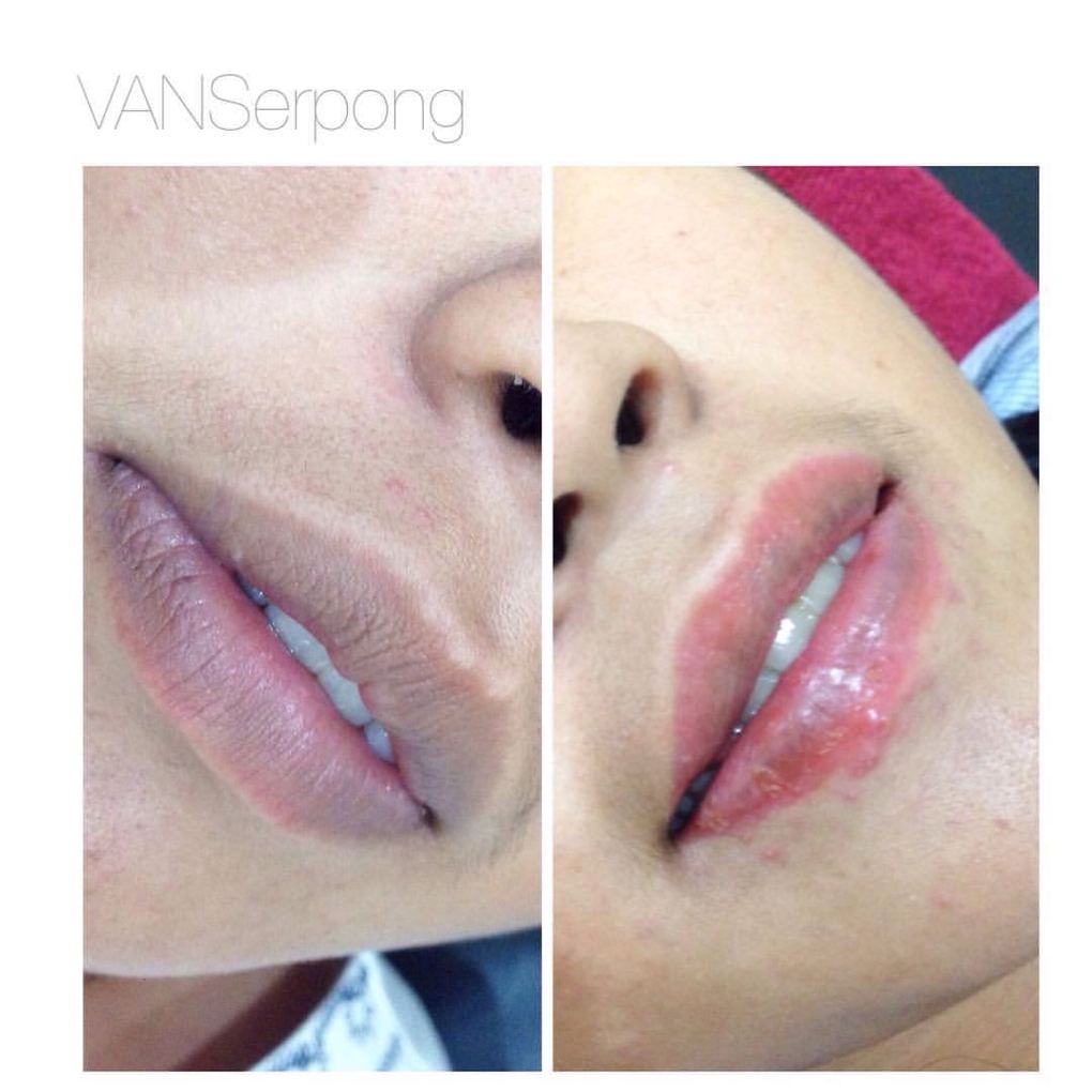 Hasil Sulam Bibir Nano