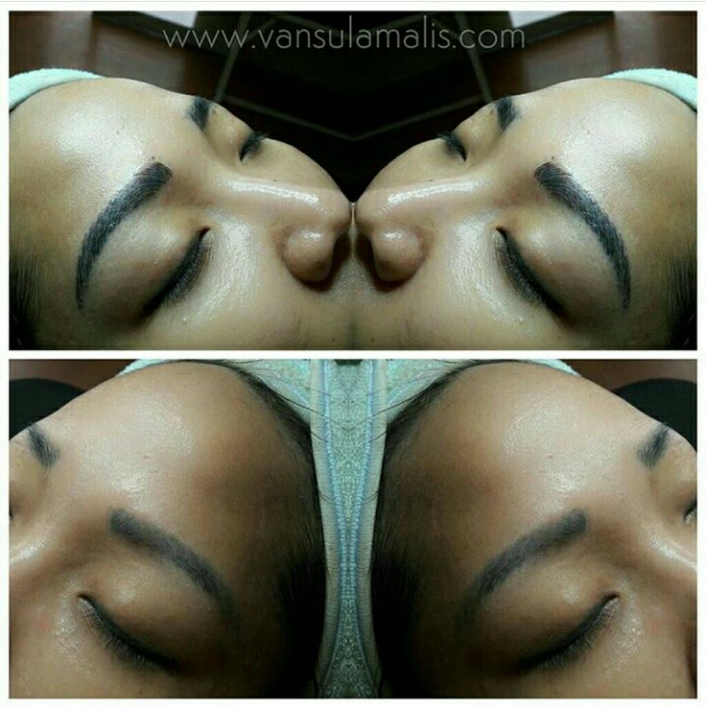 Sulam Alis 6Dimensi (bekas sulam) di Ponorogo