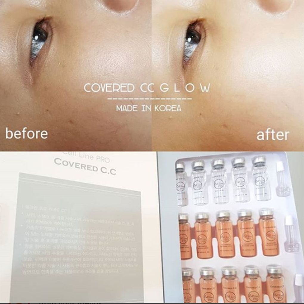 Hasil CC Glow 1x Treatment di Pik Jakarta Utara