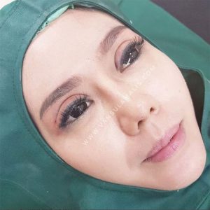 Hasil Sulam Lipatan Mata tanpa Operasi (baru jadi)