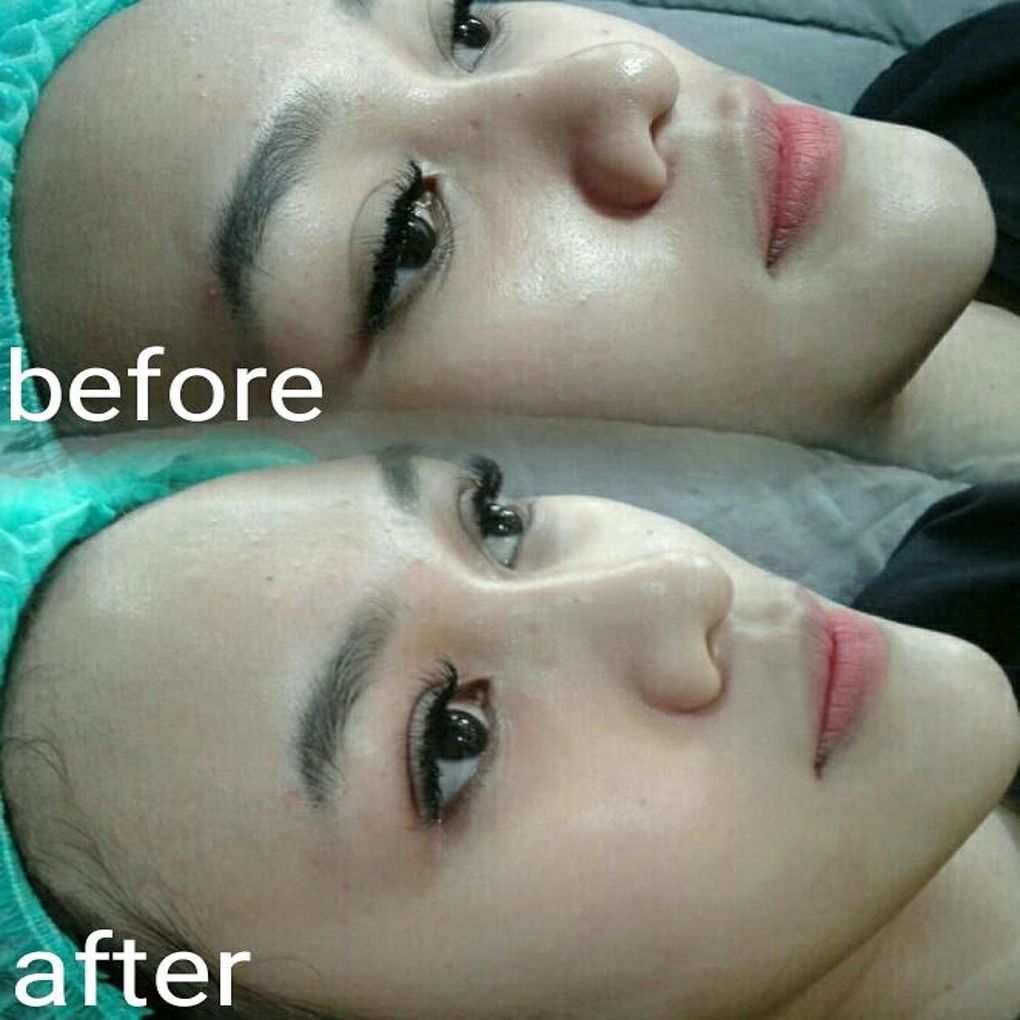 Hasil CC Glow di Cengkareng