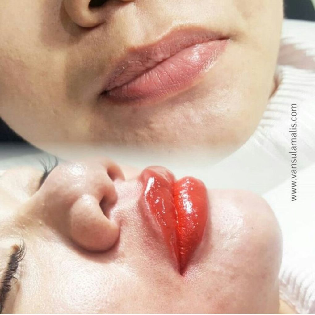 Sulam Bibir 9 November 2017