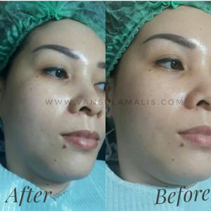 Hasil BB Glow di Pik 30 Desember 2017