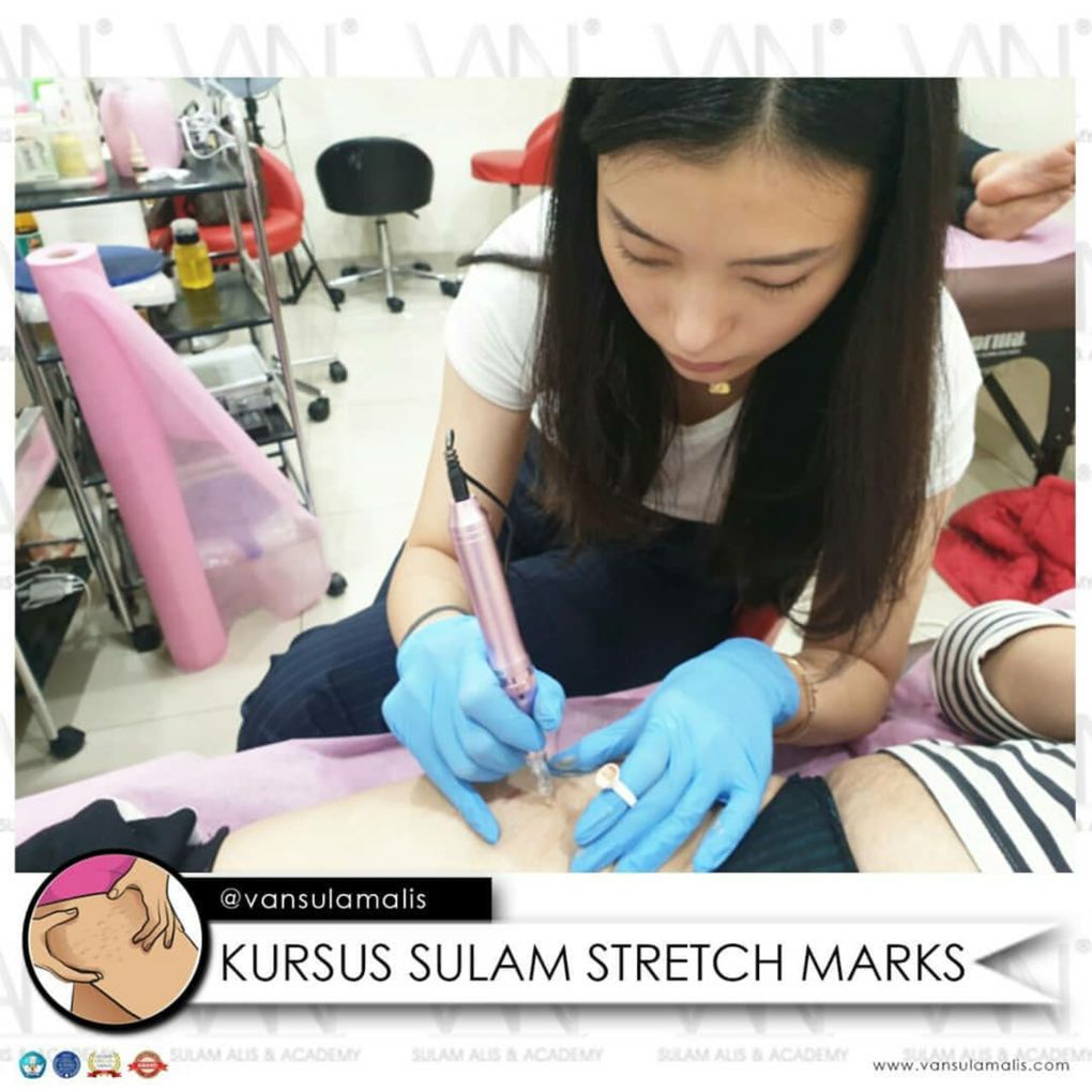 KURSUS SULAM STREATCH MARKS